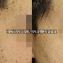 라메스피부과의원 이미지