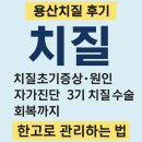 용산-386 | 용산치질·치질3기·항문피*증상부터 원인, 자가진단, 수술 후기와 회복 팁까지