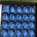 척병원 | 부산 연세척병원 : 어깨 &amp; 관절치료 후기