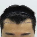 압구정맘모스헤어라인의원 이미지