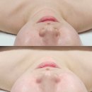 부산 동래피부관리 ‘뷰티예가 수기명장’의 안면윤곽관리 후기