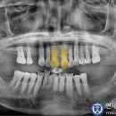 연세강치과의원 이미지