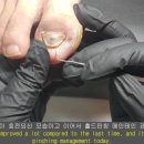 홀드핀칭 이미지