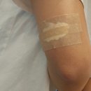 서울성형외과의원 | [서울/강남] 컴포트성형외과의원 문신제거 내돈내산 후기 1