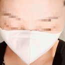 프러스덴탈 | 새부리형마스크 국산MB필터 브이가드 숨쉬기 편한 3D마스크 일반마스크 두코마스크 두코몰 브이콧대...