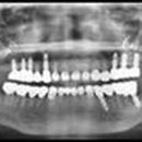 현대의수족 이미지