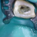 리볼리치과의원 | 오리역 치과 추천 ‘리볼리치과’ – 임플란트·신경치료 솔직 후기 (치과 무서운 분들께 진짜 추천)