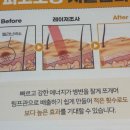 비에프케어