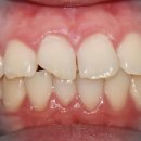 테크노파크역1-1 이미지