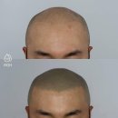프로스칼프부산 이미지