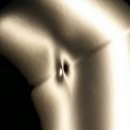 터보덴트 Daum카페