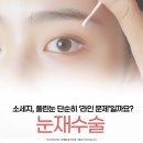 센텀비비의원 | 대구 성형외과 눈재수술, 소시지눈 풀린눈 다시 실패하지 않는 기준