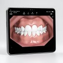 중화다인치과의원 | 나도 이제 환하게 웃을 수 있다! 연세 유앤아이치과 다녀온 썰 풉니다