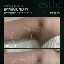 더모어뷰티 - 안동시 | 광안리 지방흡입 후관리 바본관리전문 샵 더모어뷰티 받아본 솔직후기