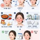 황수란피부과의원 | 주사피부염 치료 후기/미노씬·수란트라·사이폴 치료 후에도 왜 얼굴열감은 다시 올라왔을까?