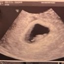 정성산부인과의원 | 마포구 분만 산부인과 후기-진오비산부인과,신촌연세퀸,신앤홍산부인과,강북삼성병원,다이아산부인과