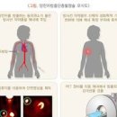 PET CT 검사 금식 시간 비용 결과 부작용 펫시티 알아야 할 정보는 이미지