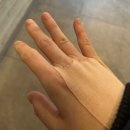 바른한의원 | 울산 동구 바른한의원 내돈내산 후기