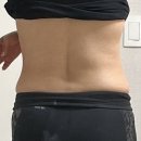 (주)강산에너지 | 신사역 피부과 바디 온다 리프팅 무제한 지방분해주사 잘하는 곳 복부 옆구리 라인 솔직 후기