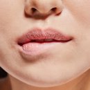 입술 각질 원인 및 입술 각질 제거 어떻게 할까? 이미지