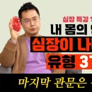 심장이 안좋을 때 나타나는 증상들 이미지