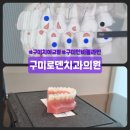 우리들치과의원 | 294. 구미 치아 교정 인비절라인 후기 :: 구미로덴치과의원 (ft. 중1 여아 치아교정 후기 1 )