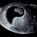 다모아탑클린 | [태아보험 내돈내산]대문자 J가 3개월간 공부해서 가입한 후기 / 만기설정, 필수특약, 설계사찾기 등