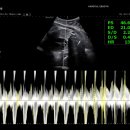 31140-7-55-32 | 임신 기록 ⑪ 32주 6일차/임신 후기 정기검진/태아 머리 내려감/머리카락 찰랑찰랑