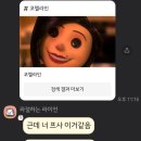 스마일 토이 | [후기] 🏖여름에 했던 스마일라식 내돈내산 후기&amp;증상😎 | 수술 직후~2년 경과 | 수원 스마일라식