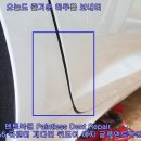 크라운덴트 이미지