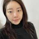 이엘약국 | 대구대명동피부관리 &#34;이엘뷰티&#34; 세멘시트관리 피부도로공사