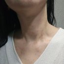 보배솔루션