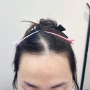 [대구/중구] 대구반월당 헤어라인정리 탈모관리 뷔브 대구본점