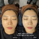 마곡 피부관리 아마릴리스뷰티 수기성형윤곽관리 후기
