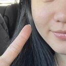 에시르의원 | W4. 울산 에시르의원 내돈내산 피코토닝 3개월 받은 솔직후기 (강추 ✨✨✨)