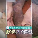 무겁고 저리고 터질듯한 통증 종아리가 아파요 이미지