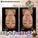 신태평양 | 부스터 피부관리 추천! 모공과 잔주름 해결하고 피부 속부터 촉촉해진 솔직 후기 (안산신부관리 필수코스)