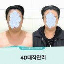 고운스킨케어 - 대덕구 | 고운빛깔에스테틱 대구점에서의 피부 관리, 진정한 스킨케어 메이크오버 후기 분석
