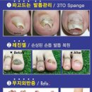 레푸스&양귀비네일