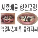고운이바른치과교정과치과의원 | [시흥/배곧] 치과 공포증 극복! 배곧 고운이교정치과 클리피씨 부착 후기 (feat. 상악악궁확장장치)