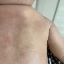 성모약국 | [부산 성모병원 김성원 원장님 초진 후기] 6개월 아기 아토피 &amp; 9개월 현재 / 대구 피부과 비추 후기