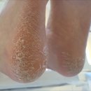 마젤네일 Mazel nail | 분당 수내동 발각질 전문샵에서 환절기 고민 싹 날리고 온 곳 마젤네일