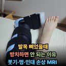 미주약국 | 발목 접질렀을때 붓기 상태 인대 늘어남 (+파스 찜질 통증 멍 테이핑 깁스) 2세대 실비보험