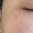 차약국 | 약국 도미나크림 2주차 후기
