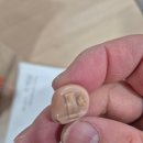 밝은소리보청기 이미지