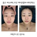 울산 에스테틱 추천 제이앤콤마 피부앤왁싱 미백관리 받고 왔어요