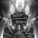 척추 측만증 디스크요통 진단과 치료 이미지