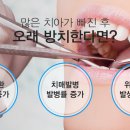 틀치과의원