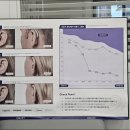 청담보청기 이미지