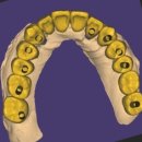 서울좋은치과기공소 이미지
